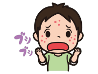 はしか(麻疹)